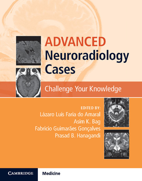 Cover image for book Advanced Neuroradiology Cases