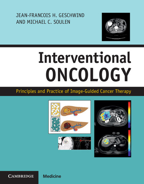 Cover image for book Interventional Oncology