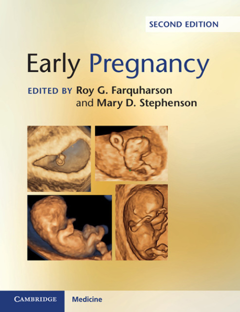 Cover image for book Early Pregnancy
