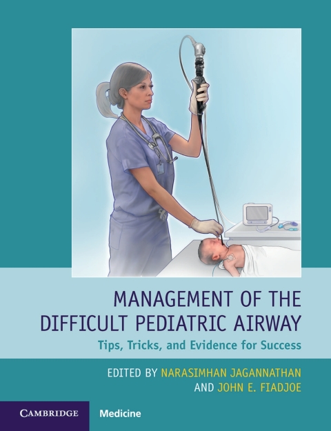 Cover image for book Management of the Difficult Pediatric Airway
