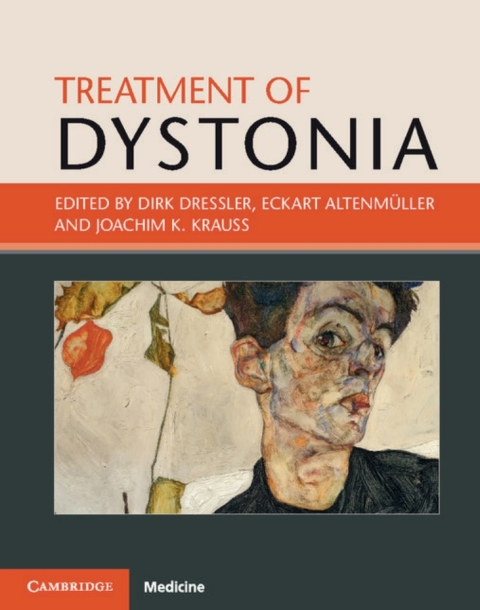 Cover image for book Treatment of Dystonia