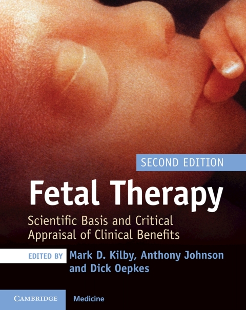 Cover image for book Fetal Therapy