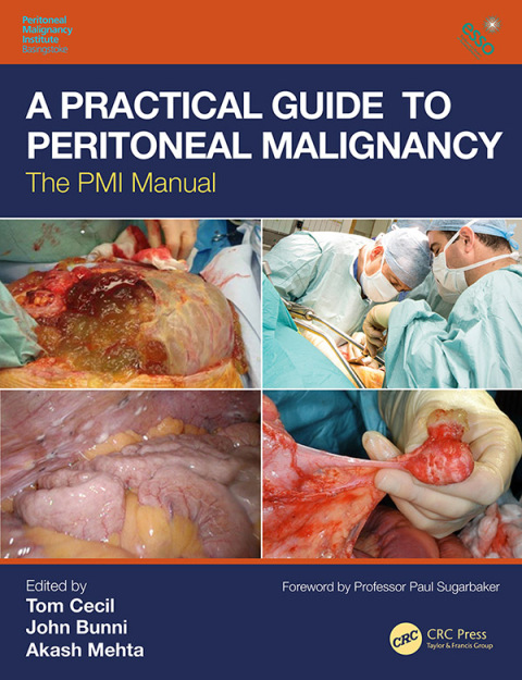 Cover image for book A Practical Guide to Peritoneal Malignancy
