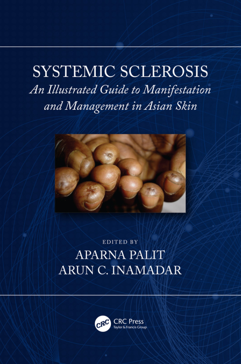 Cover image for book Systemic Sclerosis