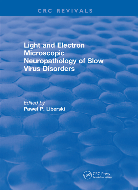 Cover image for book Light And Electron Microscopic Neuropathology of Slow Virus Disorders