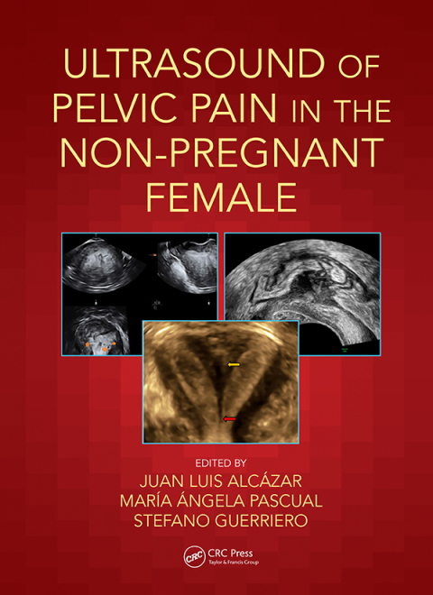 Cover image for book Ultrasound of Pelvic Pain in the Non-Pregnant Patient