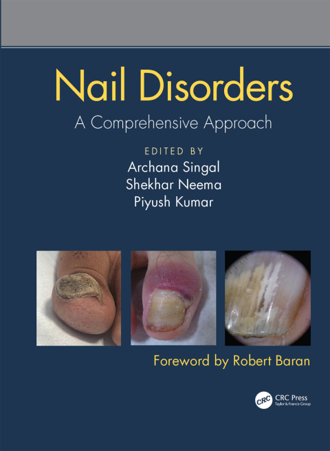 Cover image for book Nail Disorders