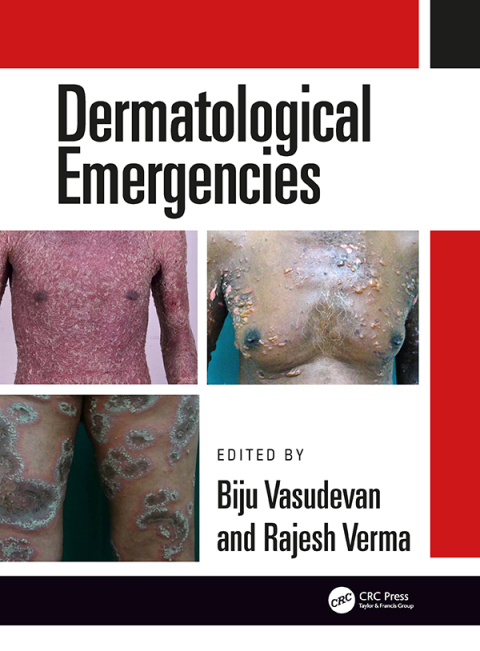 Cover image for book Dermatological Emergencies