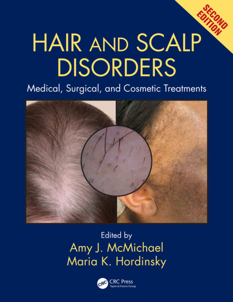 Cover image for book Hair and Scalp Disorders