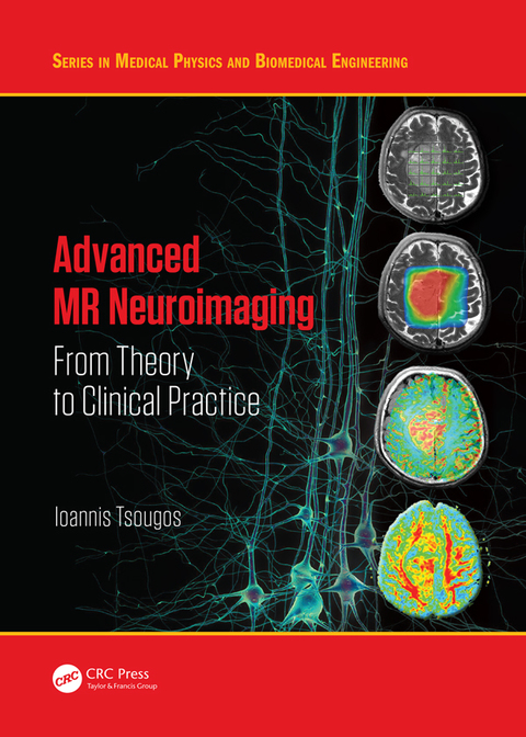 Cover image for book Advanced MR Neuroimaging
