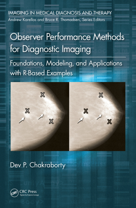 Cover image for book Observer Performance Methods for Diagnostic Imaging
