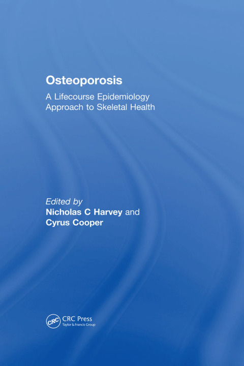 Cover image for book Osteoporosis