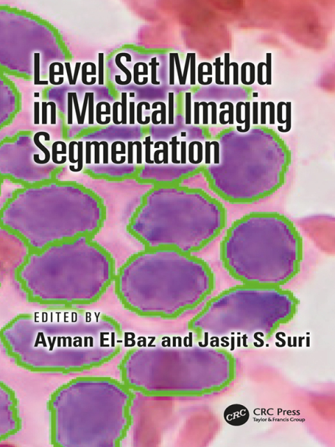 Cover image for book Level Set Method in Medical Imaging Segmentation