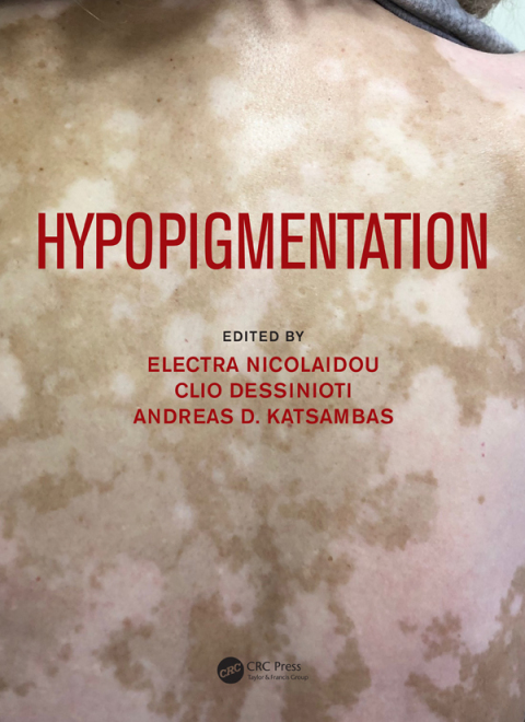 Cover image for book Hypopigmentation
