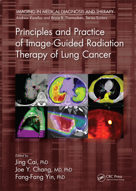 Cover image for book Principles and Practice of Image-Guided Radiation Therapy of Lung Cancer