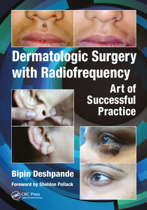 Cover image for book Dermatologic Surgery with Radiofrequency