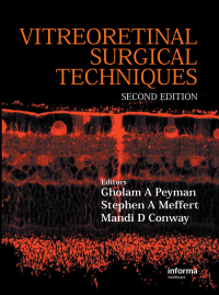 Cover image: Vitreoretinal Surgical Techniques, Second Edition 2nd edition 9781841846262