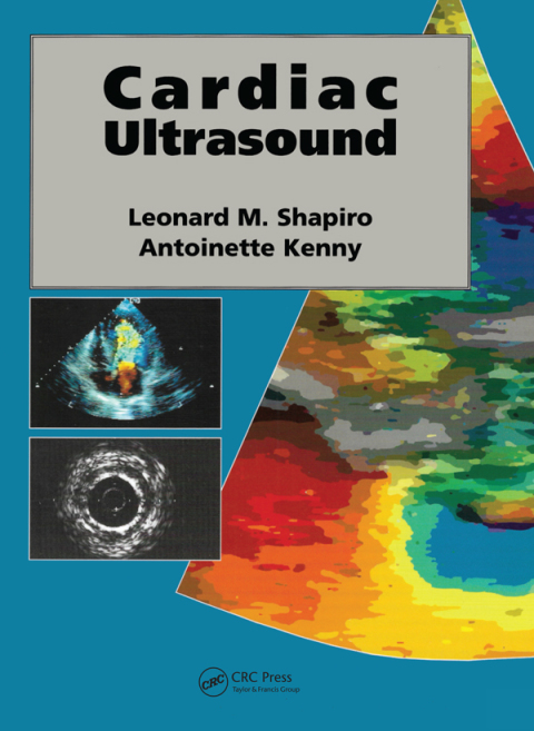 Cardiac Ultrasound 