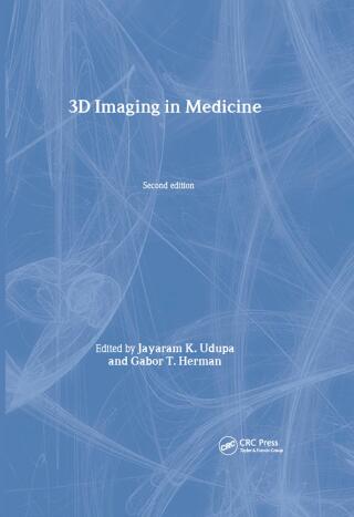 3D Imaging in Medicine, Second Edition