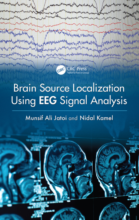 Cover image for book Brain Source Localization Using EEG Signal Analysis