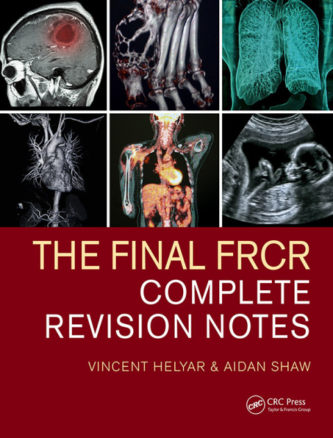 Cover image for book The Final FRCR