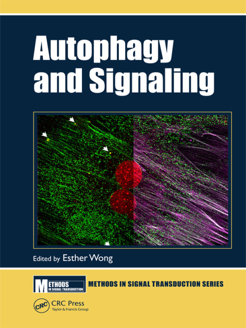Cover image for book Autophagy and Signaling