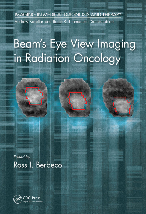 Cover image for book Beam's Eye View Imaging in Radiation Oncology