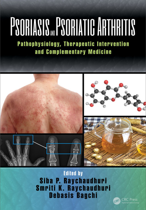 Cover image for book Psoriasis and Psoriatic Arthritis