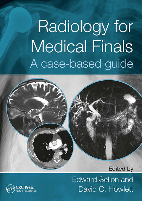 Cover image for book Radiology for Medical Finals