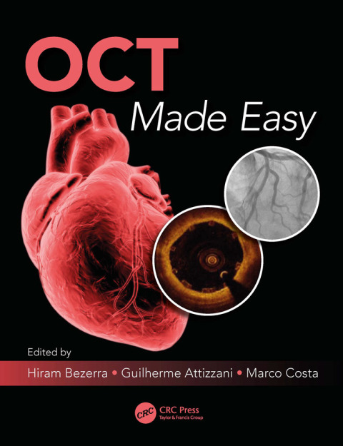 Cover image for book OCT Made Easy