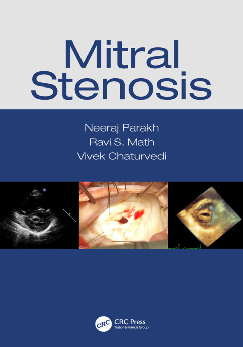 Cover image for book Mitral Stenosis