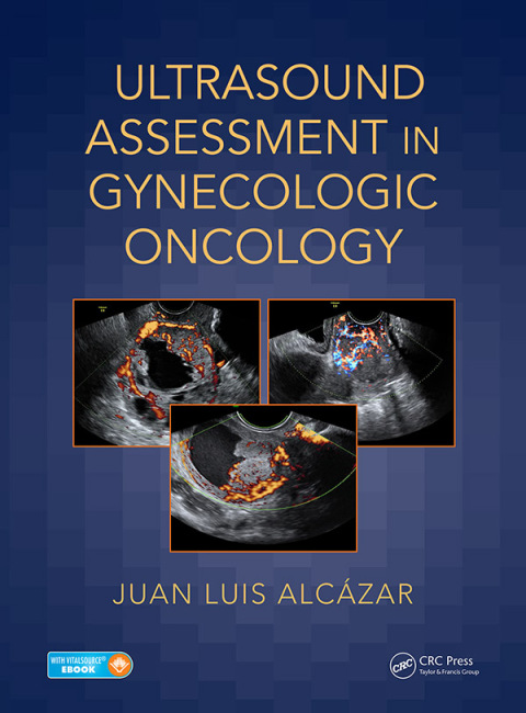 Cover image for book Ultrasound Assessment in Gynecologic Oncology