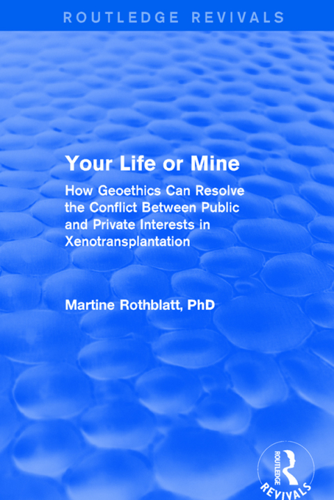 Cover image for book Your Life or Mine