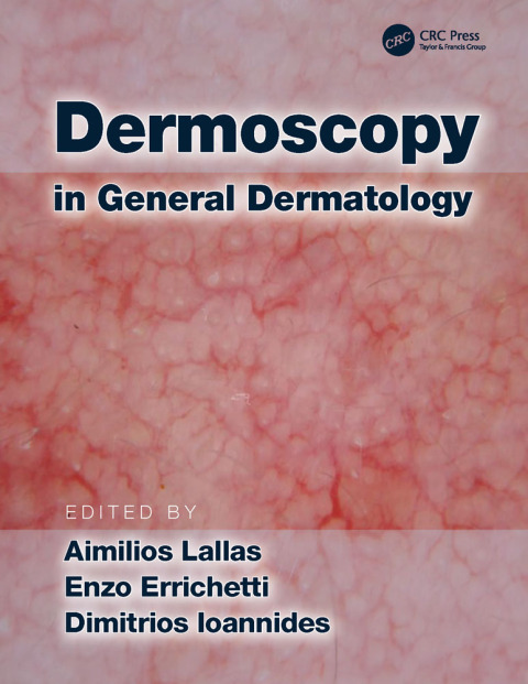 Cover image for book Dermoscopy in General Dermatology