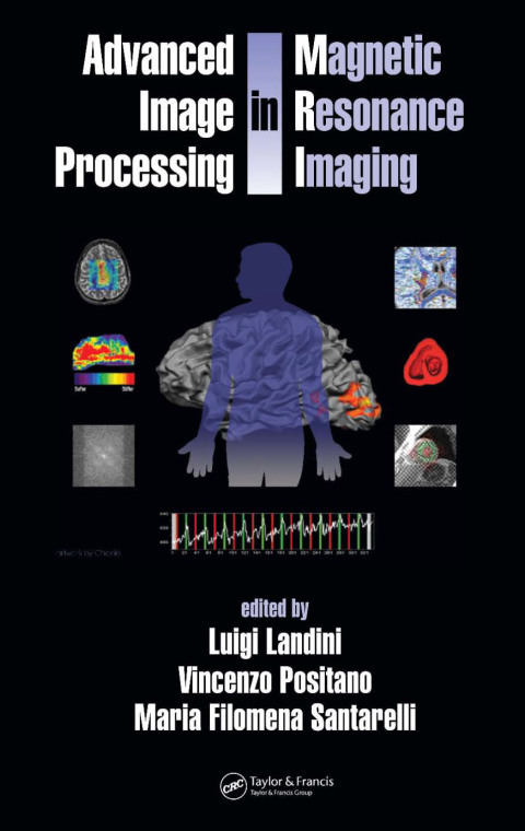 Cover image for book Advanced Image Processing in Magnetic Resonance Imaging