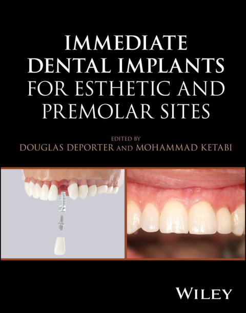 Cover image for book Immediate Dental Implants for Esthetic and Premolar Sites