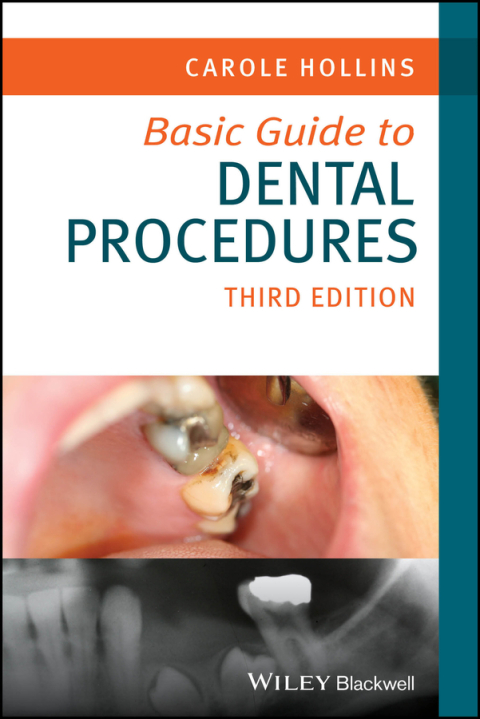 Cover image for book Basic Guide to Dental Procedures
