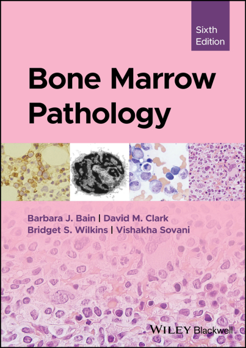 Bone Marrow Pathology 