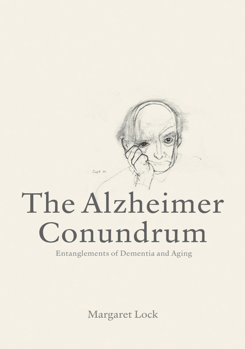 Cover image for book The Alzheimer Conundrum