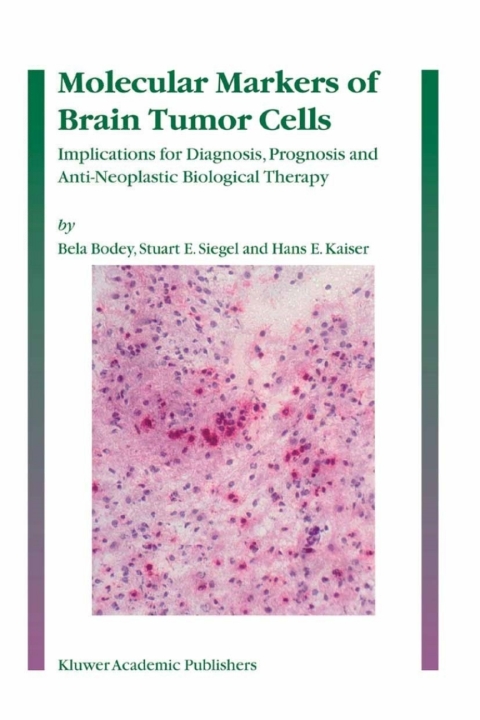 Cover image for book Molecular Markers of Brain Tumor Cells