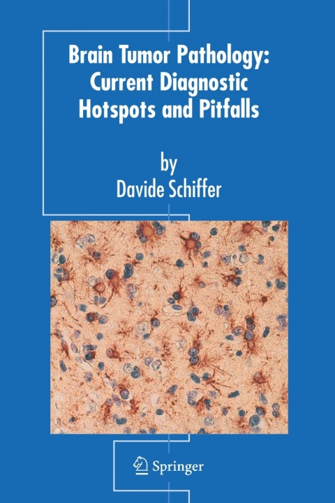 Cover image for book Brain Tumor Pathology: Current Diagnostic Hotspots and Pitfalls