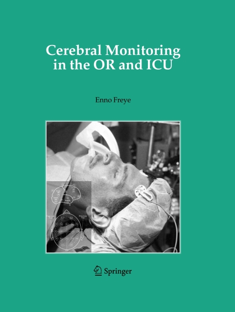 Cover image for book Cerebral Monitoring in the OR and ICU