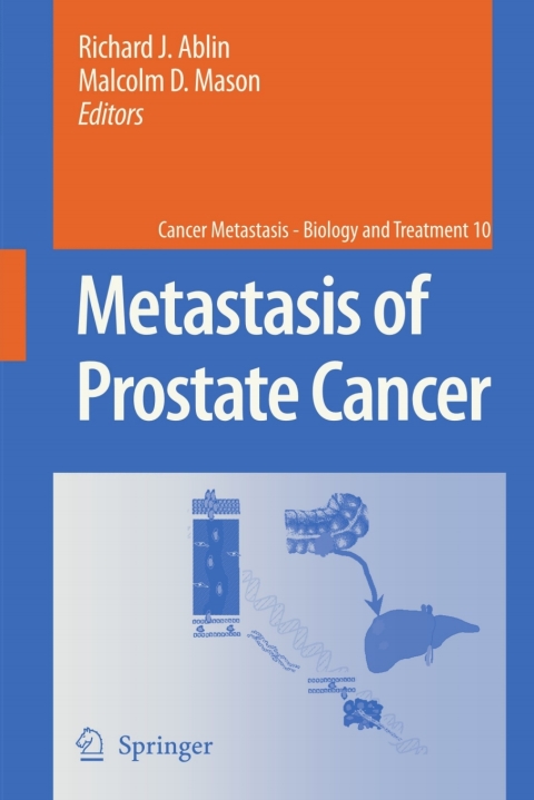 Cover image for book Metastasis of Prostate Cancer