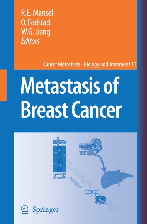 Cover image for book Metastasis of Breast Cancer