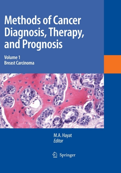 Cover image for book Methods of Cancer Diagnosis, Therapy and Prognosis