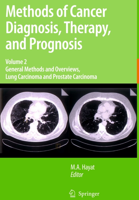 Cover image for book Methods of Cancer Diagnosis, Therapy and Prognosis