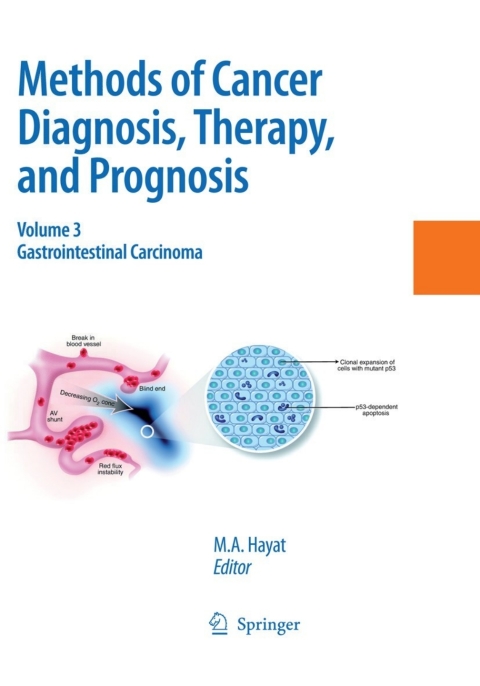 Cover image for book Methods of Cancer Diagnosis, Therapy and Prognosis