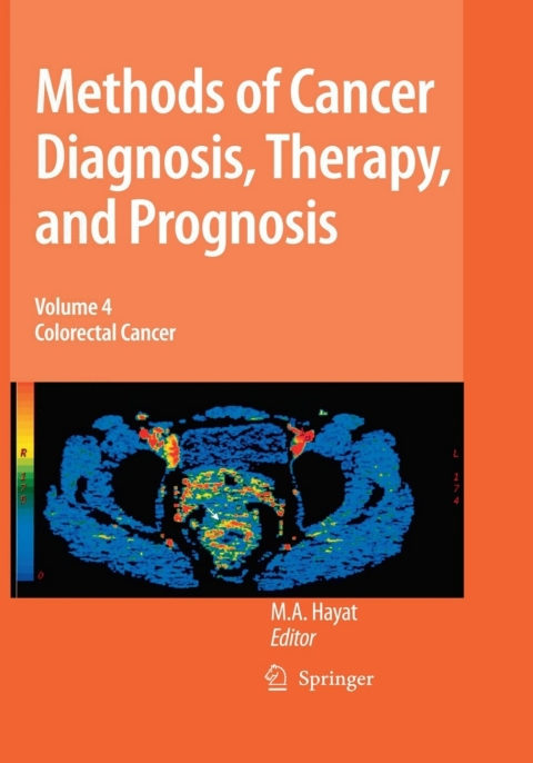 Cover image for book Methods of Cancer Diagnosis, Therapy and Prognosis