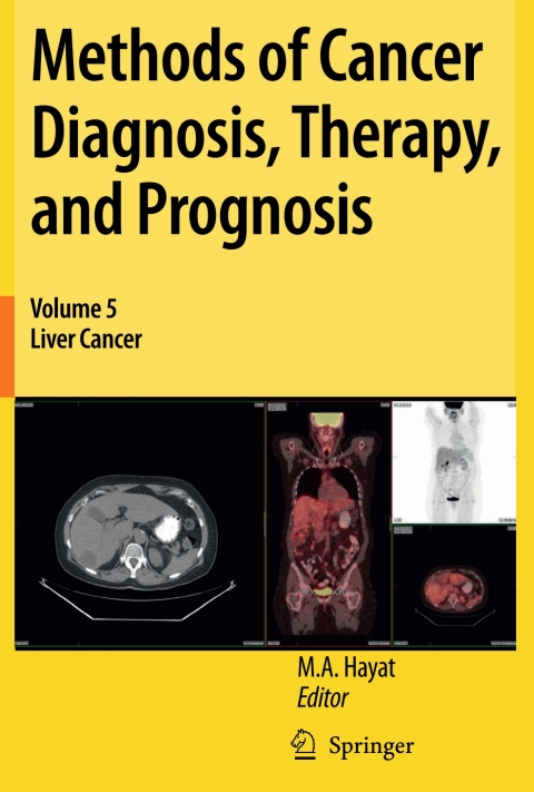 Cover image for book Methods of Cancer Diagnosis, Therapy, and Prognosis