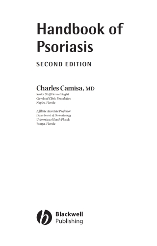 Handbook of Psoriasis